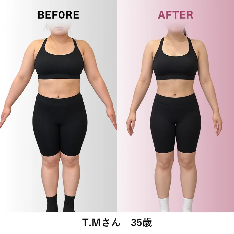 T.Mさんのビフォーアフター