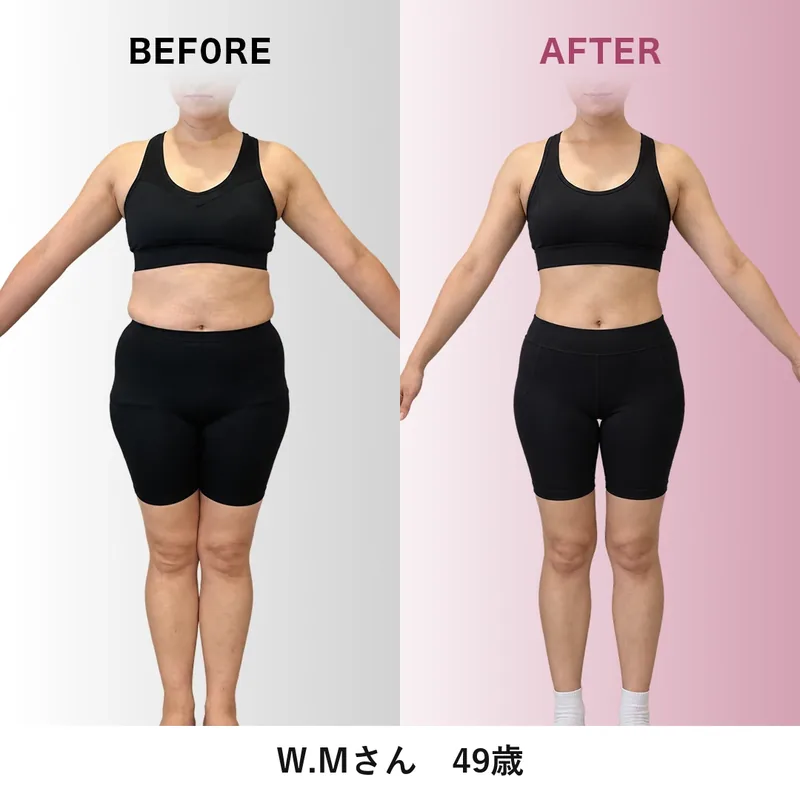 W.Mさんのビフォーアフター